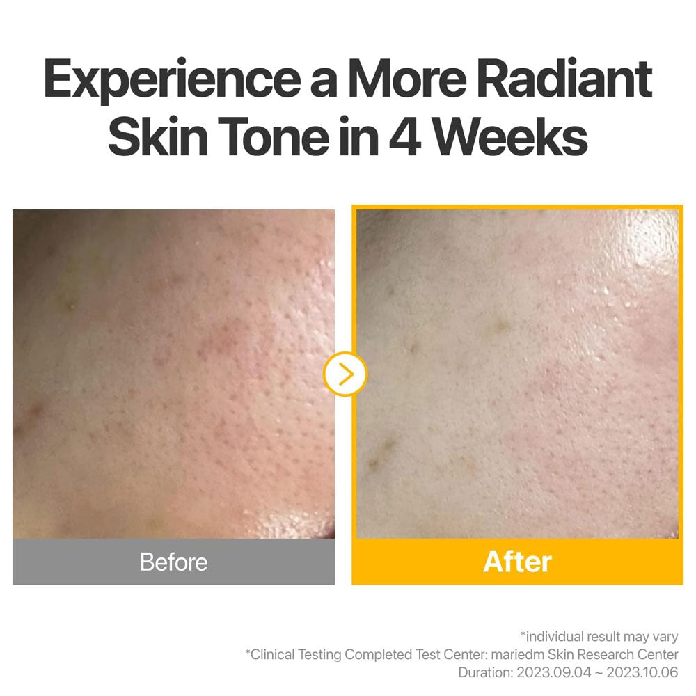 NUMBUZIN - No.5+ Glutathione Vitamin Concentrated Mask - (Single Sheet)