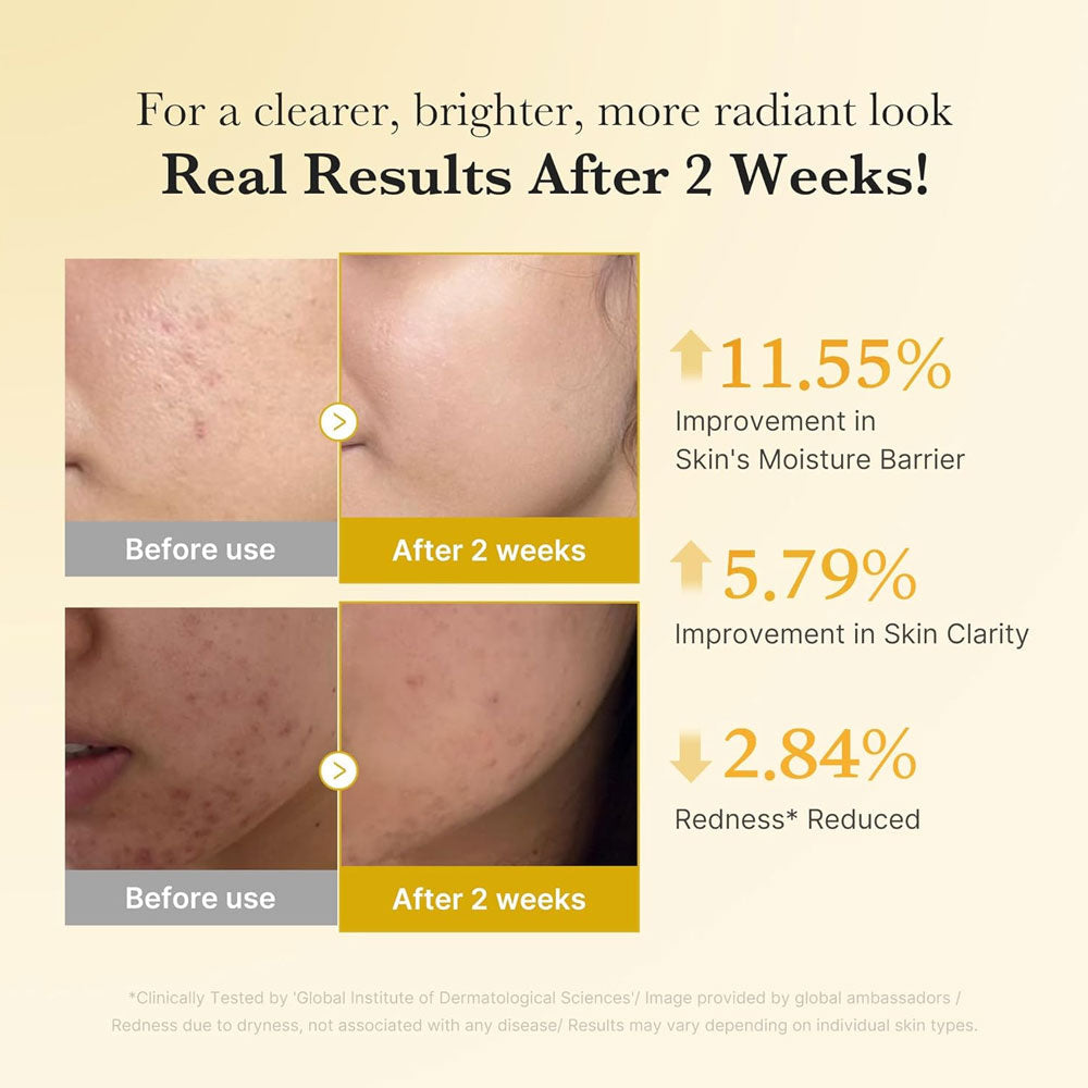 Medicube Kojic Acid Turmeric Niacinamide Serum 30ml