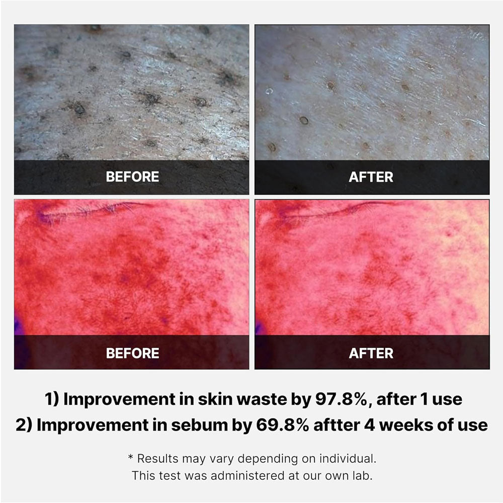 MEDICUBE Red Succinic Acid Panthenol Facial Peeling Pads - 70 Pads