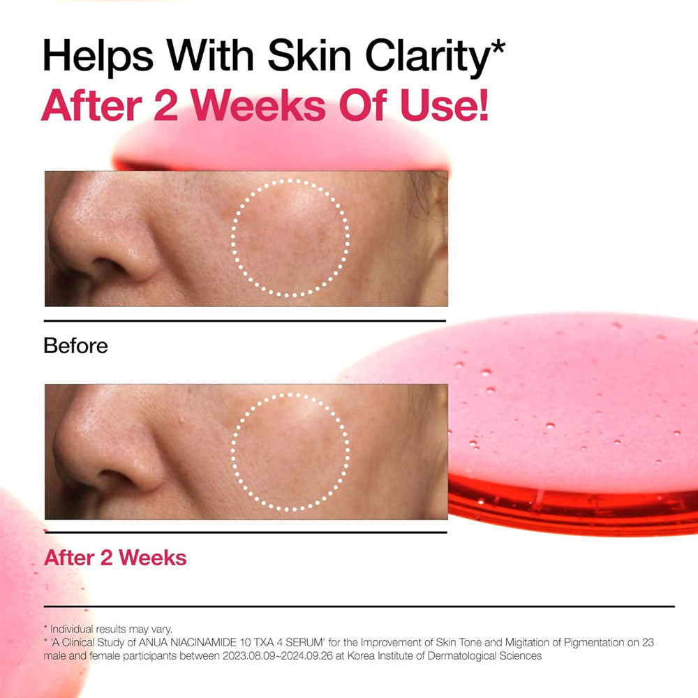 ANUA - Niacinamide 10 TXA 4 Serum - 30ml