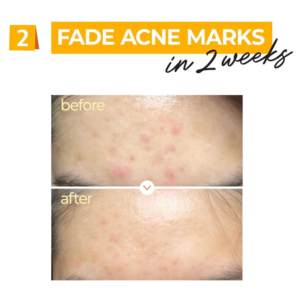 NUMBUZIN - No.5 Vitamin Concentrated Serum - 30ml