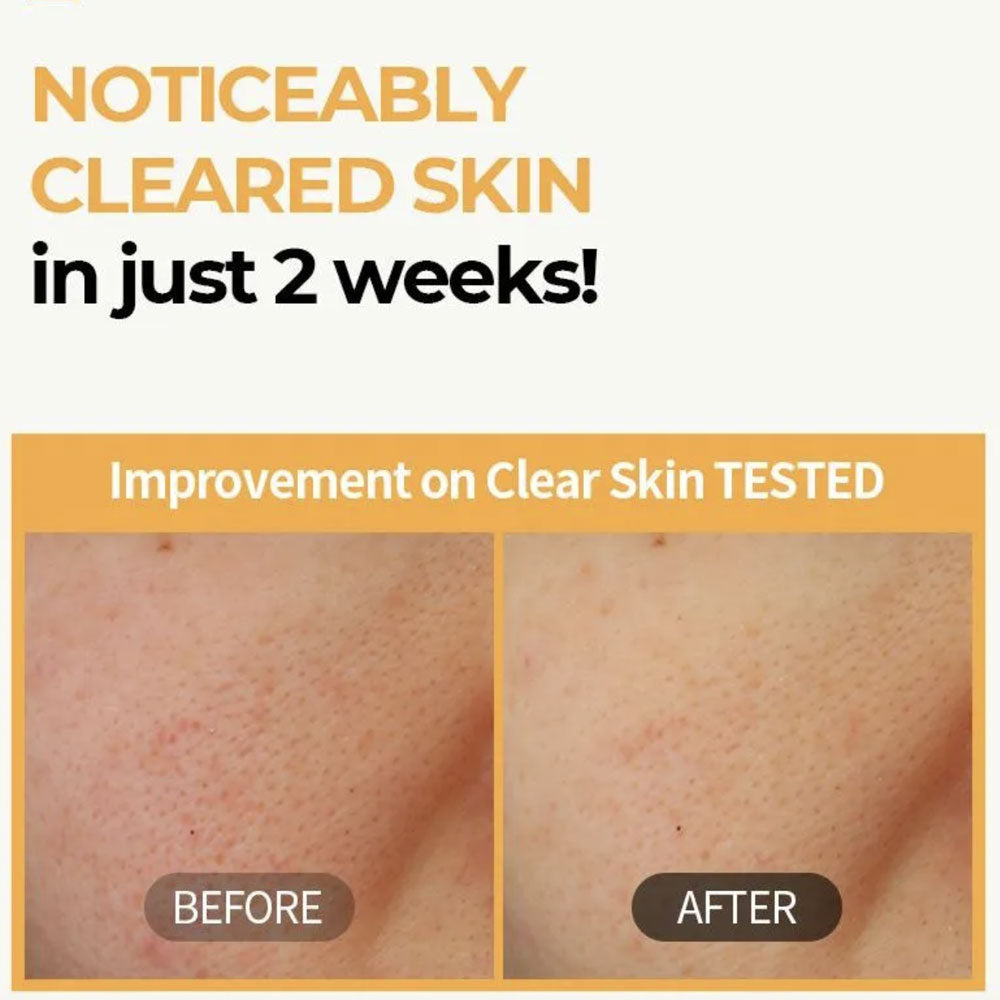 NUMBUZIN - No.3 Radiance Glowing Jumbo Essence Pad - 150ml / 70 Pads