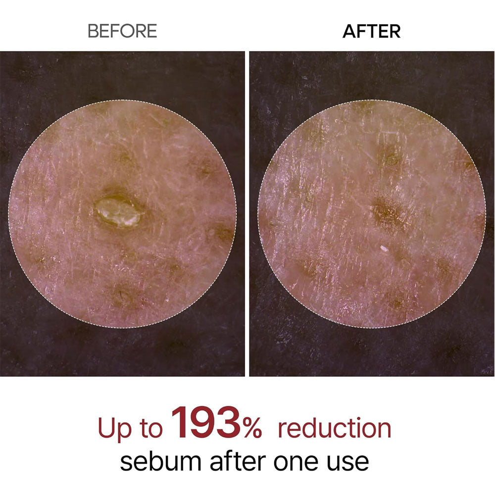 Dr.MELAXIN - Peel Shot Exfoliant Black Rice Ampoule - 80ml