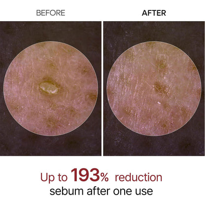 Dr.MELAXIN - Peel Shot Exfoliant Black Rice Ampoule - 80ml