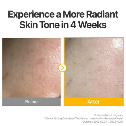 NUMBUZIN - No.5+ Glutathione Vitamin Concentrated Mask - (Single Sheet)