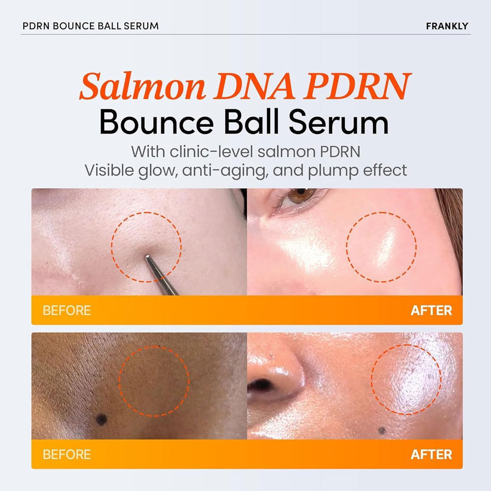 FRANKLY - PDRN Bounce Ball Serum - 30ml