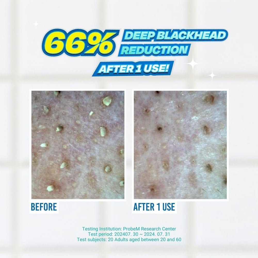 JUMISO Blackhead Melting Softener & Cotton Pad Set