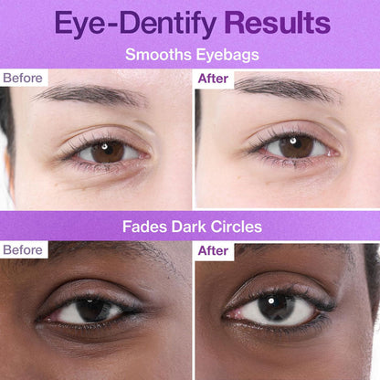 Numbuzin No.9 NAD+ Collagen Under Eye Patches 8g x 5 pairs