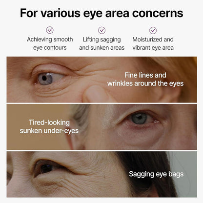 Dr.MELAXIN - Calcium Bonding Eye Cream - 15g