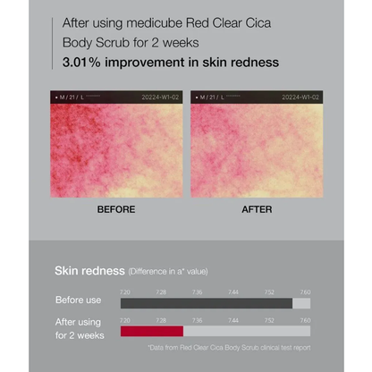 MEDICUBE- Red Clear Cica Body Scrub - 270g
