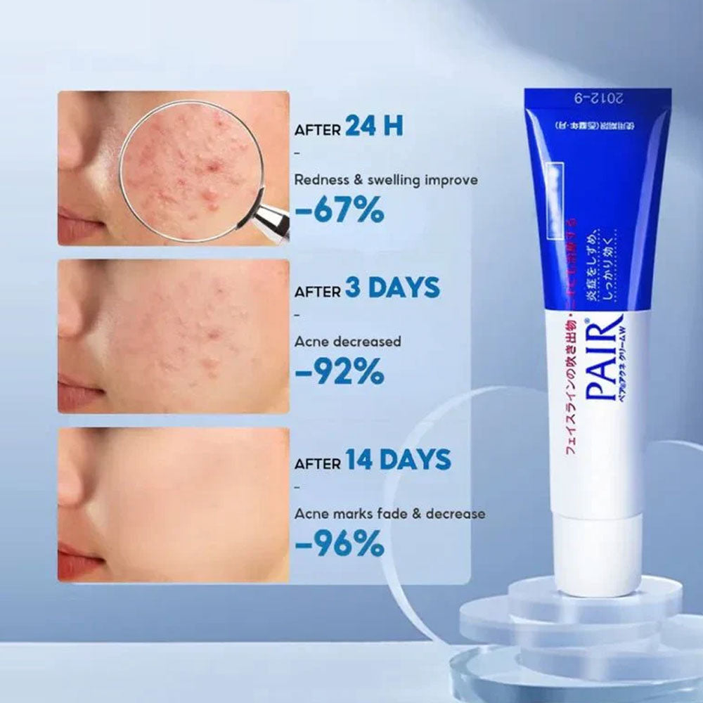 LION PAIR - Acne Cream W - 14g