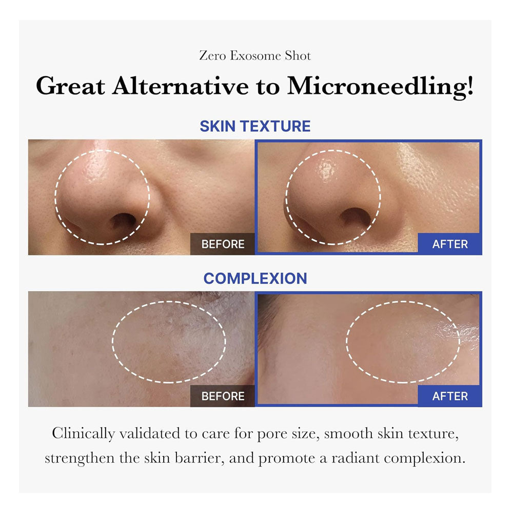 MEDICUBE - One Day Exosome Shot Pore Ampoule 2000 - 30ml