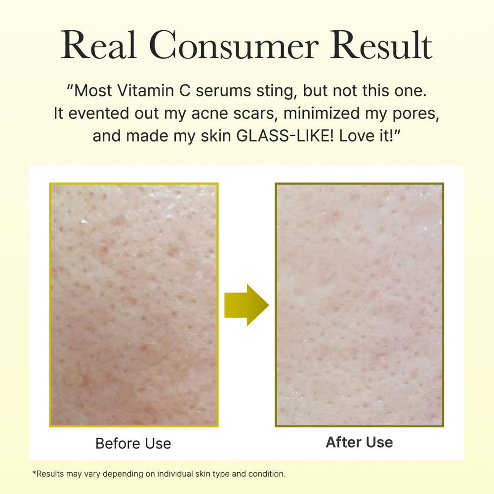 ARENCIA - Vitamin C Booster Shot - 30ml