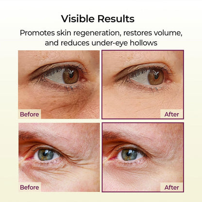 Dr.Melaxin Cemenrete Calcium Volume Multi Balm 9g