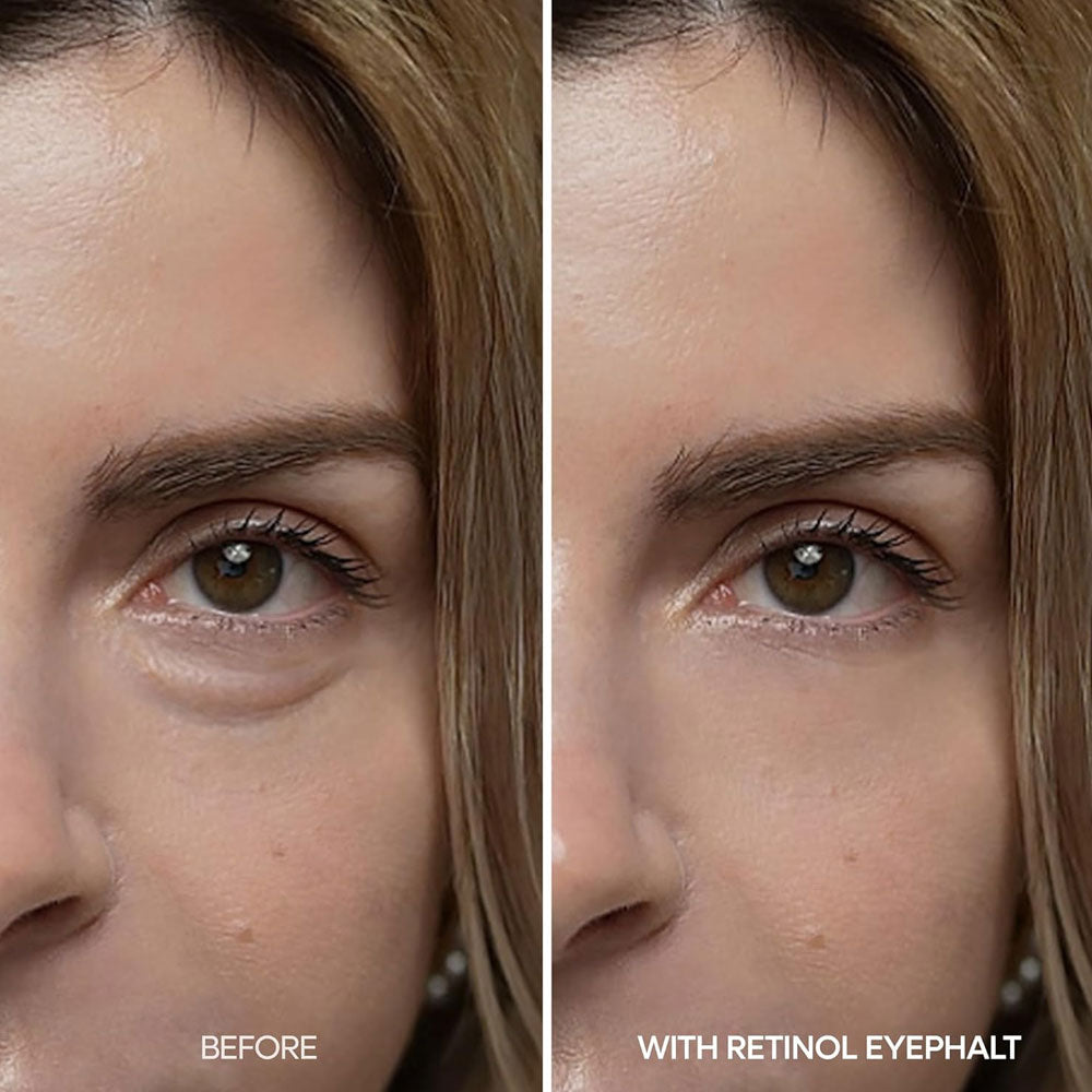 Dr.Melaxin Eyephalt Retinol Eyebag Cream 10g