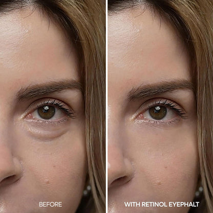 Dr.Melaxin Eyephalt Retinol Eyebag Cream 10g