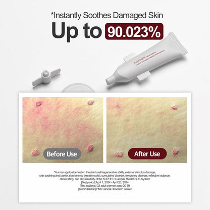 KOPHER Curepair Melder Sos System Set 20pcs