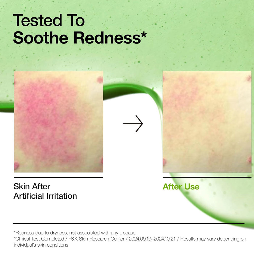 ANUA Azelaic Acid 10 Hyaluron Redness Soothing Serum 30ml