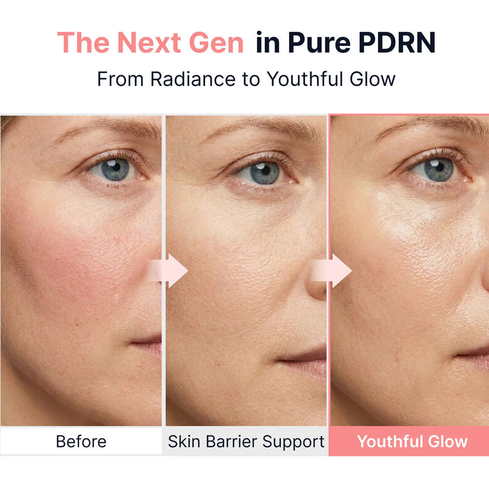 SUNGBOON EDITOR - PDRN Pink Vitamin Glow Boosting Ampoule - 40ml