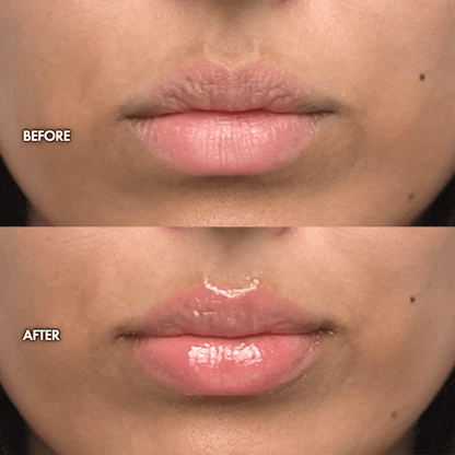 FARSALI The Lip Reset 
Ceramide + Peptide Lip Balm