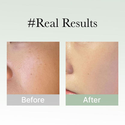 ARENCIA Holy Hyssop Serum 30 50g