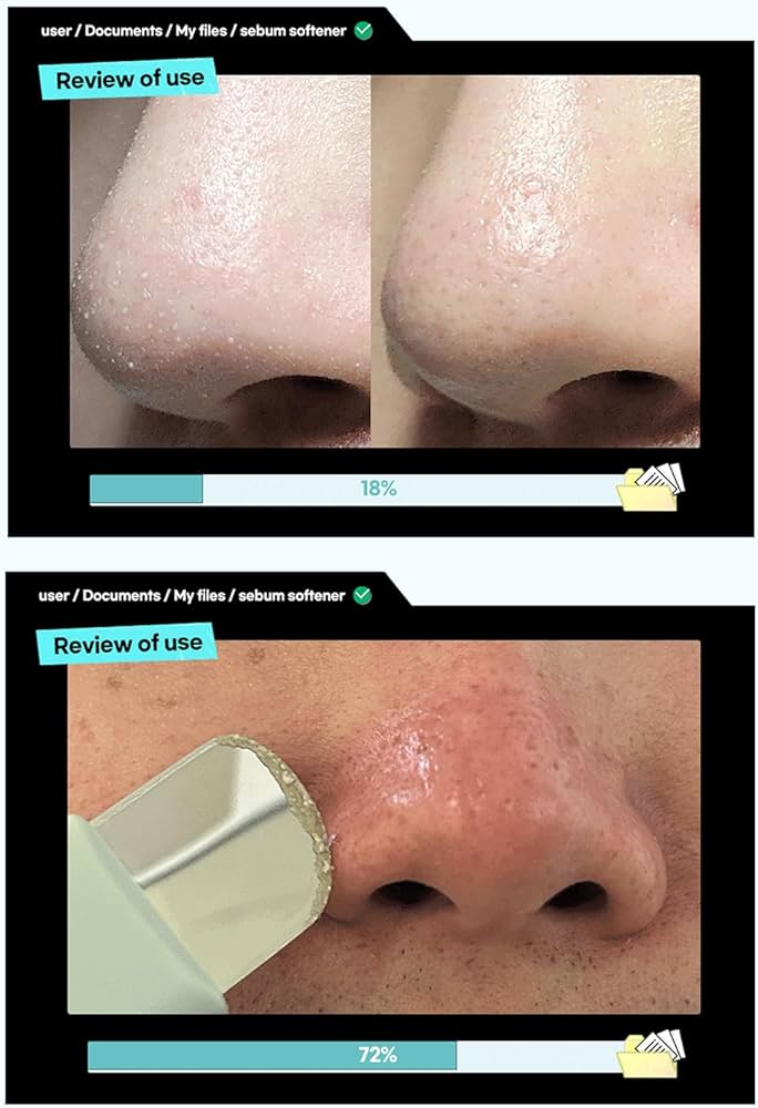 ILSO - Super Melting Sebum Softener - 150ml