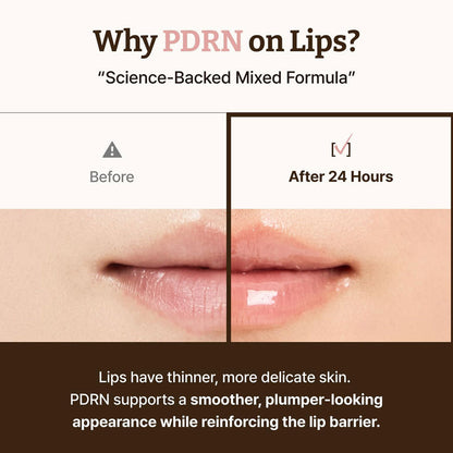 Dr. REJU ALL - Advanced PDRN Rejuvenating Lip Serum