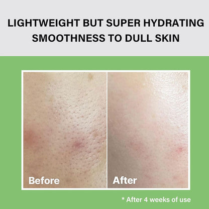 CELIMAX - The Real Noni Moisture Balancing Toner - 150ml