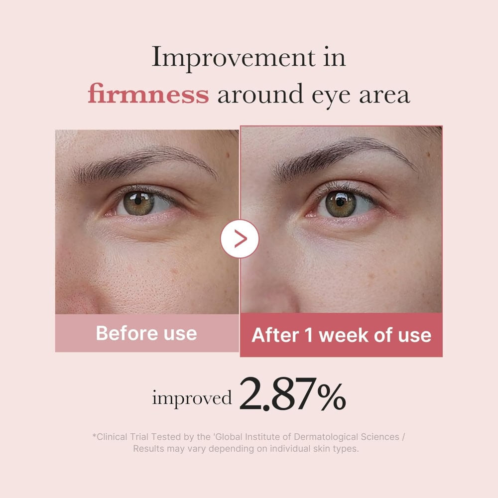 MEDICUBE - PDRN Pink Peptide Eye Serum