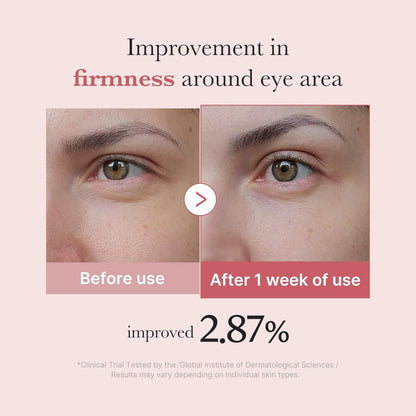 MEDICUBE - PDRN Pink Peptide Eye Serum