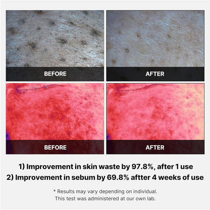 MEDICUBE Red Succinic Acid Panthenol Facial Peeling Pads - 70 Pads