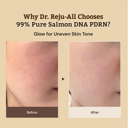 REJUALL Advanced PDRN Repair Cream 20g – Korean Pharmacy