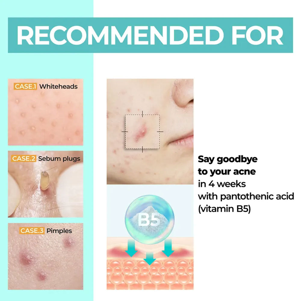 NUMBUZIN - No.1 Pantothenic B5 Active Soothing Cream - 80ml