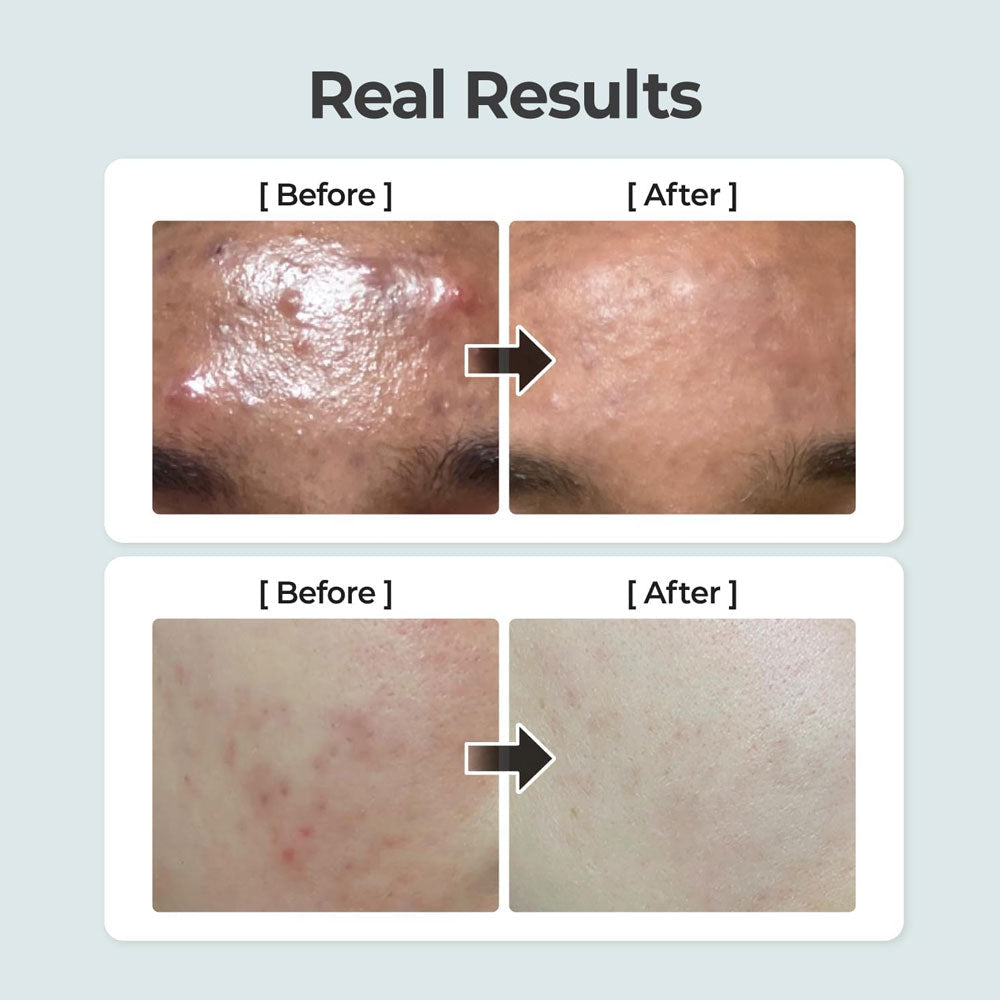 NUMBUZIN - No.1 Pure-Full Calming Herb Toner - 300ml