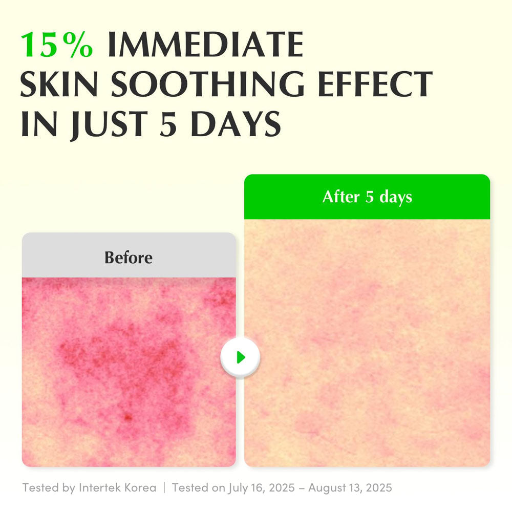 EQQUALBERRY - Aloe PDRN Calming Serum - 30ml