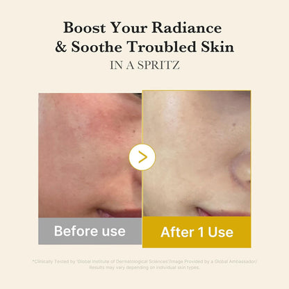 MEDICUBE - Kojic Acid Turmeric Vita Jelly Mist Serum - 100ml