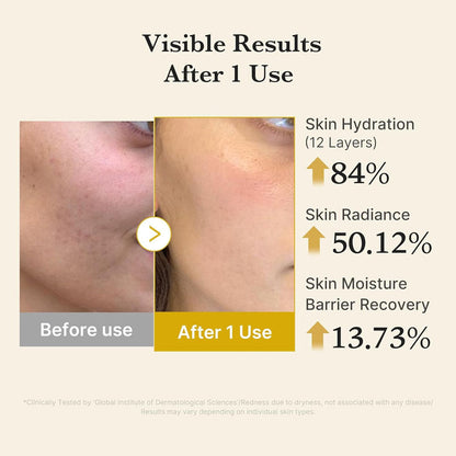 MEDICUBE - Kojic Acid Turmeric Vita Jelly Mist Serum - 100ml