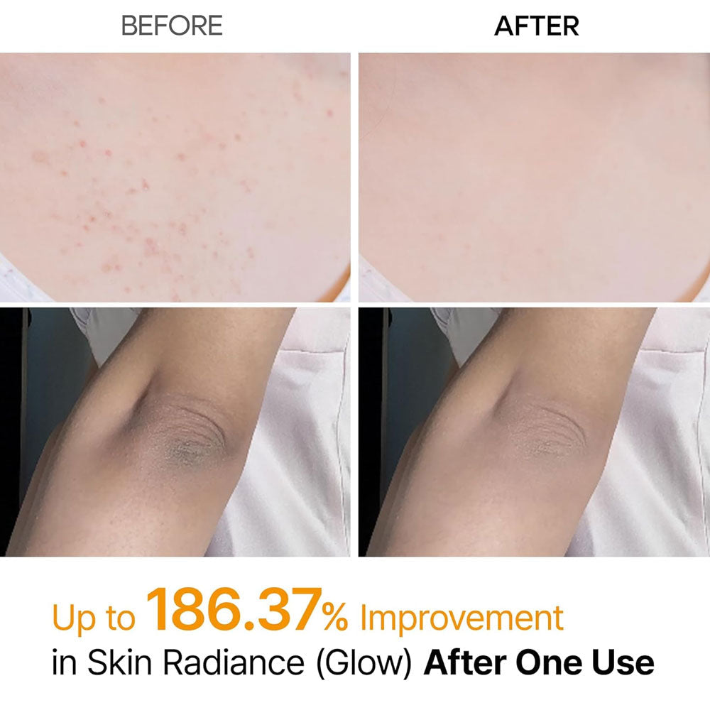 Dr.MELAXIN - Peel Shot Exfoliating Kojic Acid Turmeric Spray - 200ml