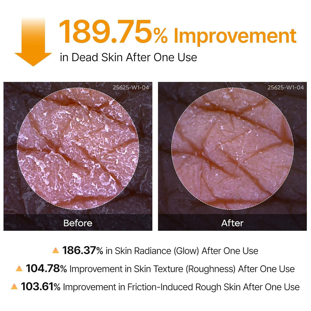 Dr.MELAXIN - Peel Shot Exfoliating Kojic Acid Turmeric Spray - 200ml