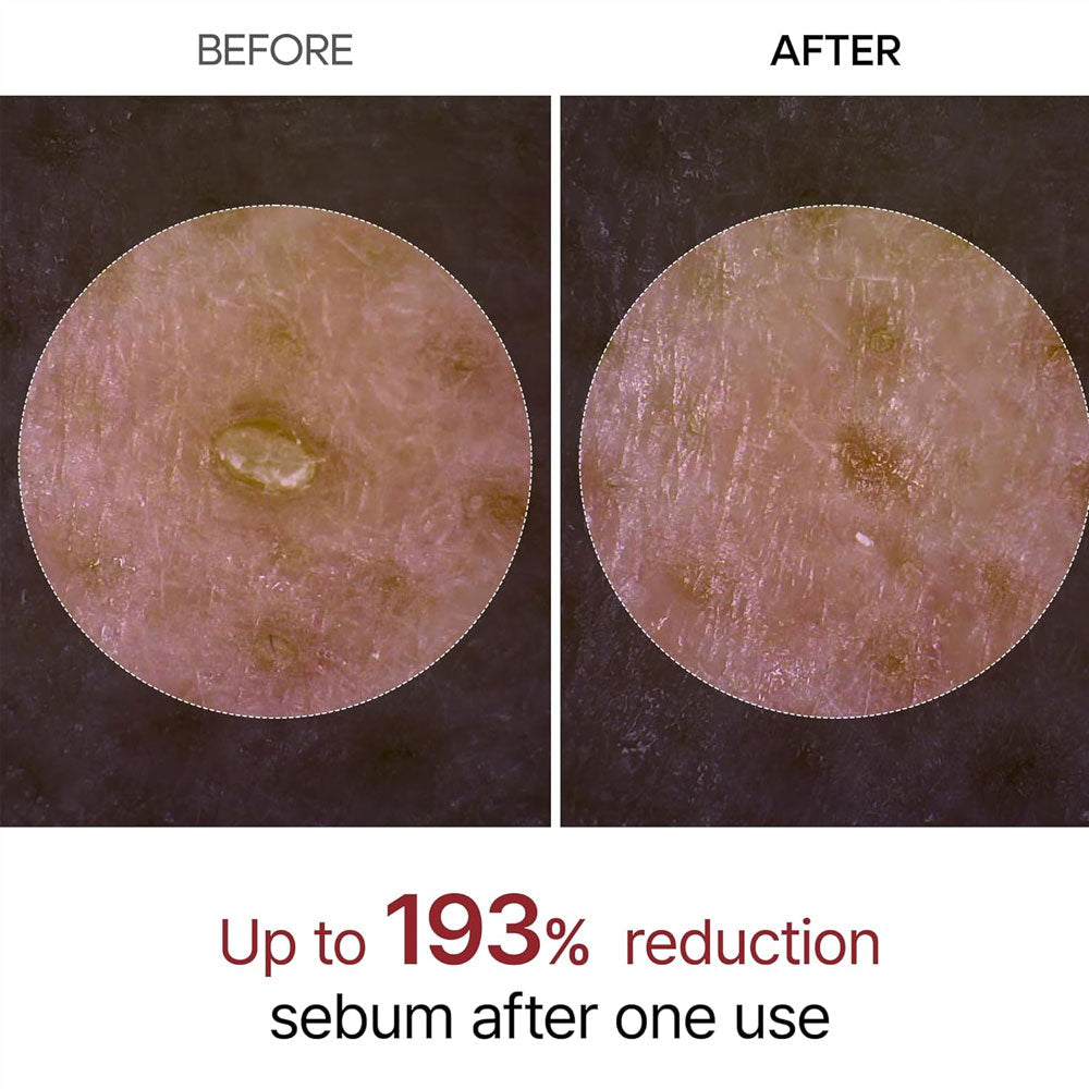 Dr.MELAXIN - Peel Shot Exfoliant White Rice Ampoule - 80ml