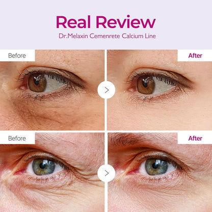 Dr.MELAXIN - Cemenrete Calcium Volume Eye Patch - 60ea