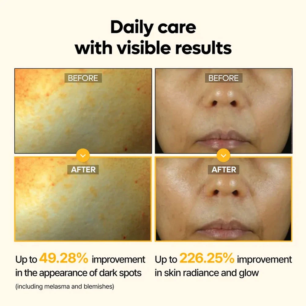 Dr.MELAXIN - Kojic Acid Turmeric Serum - 50ml